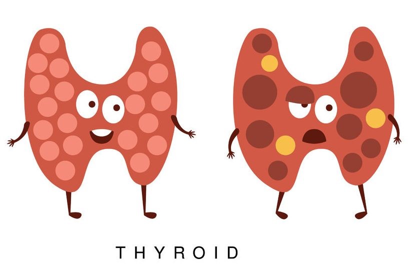 Thyroid advisor